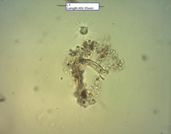 Raphidocystis