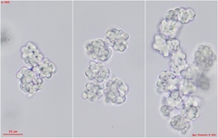 Dictyocatenulata alba