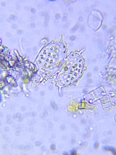 Xanthidium tetracentrotum