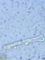 Actinella punctata