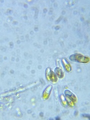 Ophiocytium