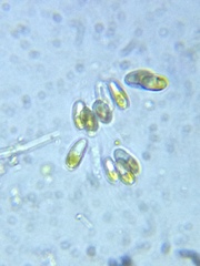 Ophiocytium