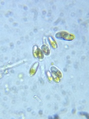 Ophiocytium