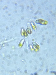 Ophiocytium