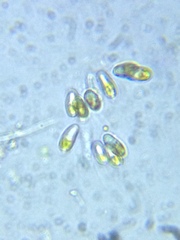 Ophiocytium