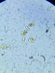Ophiocytium