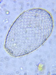 Euglyphidae