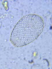 Euglyphidae