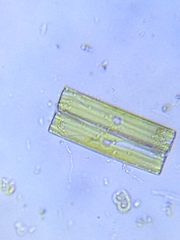 Diatomella