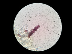 Ascobolus lignatilis