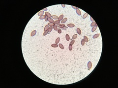 Ascobolus lignatilis