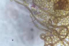 Trichia botrytis