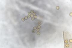 Trichia botrytis