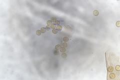 Trichia botrytis