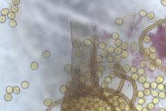 Trichia botrytis