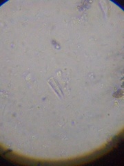 Spirochaetales
