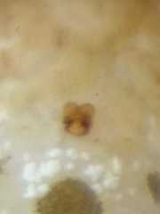 Platnickina