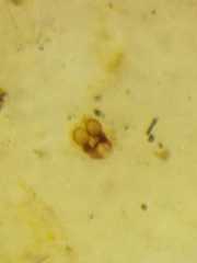 Platnickina