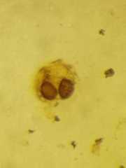 Argyrodes fissifrons