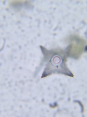 Staurastrum cerastes