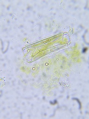 Diatomella
