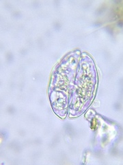 Cosmarium pseudotaxichondrum