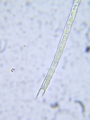Microspora