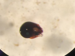 Galumnidae