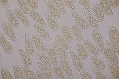 Melampsoridium betulinum