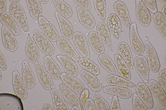 Melampsoridium betulinum