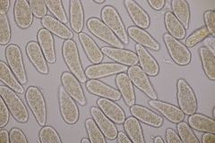 Melampsoridium betulinum