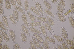 Melampsoridium betulinum