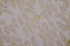 Melampsoridium betulinum