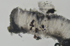 Pertusaria stenhammarii