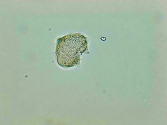 Protoperidinium