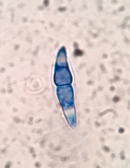 Pseudotrichia mutabilis