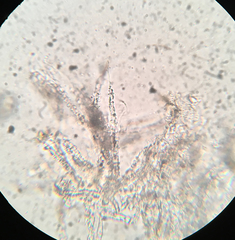 Flagelloscypha minutissima