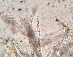 Flagelloscypha minutissima