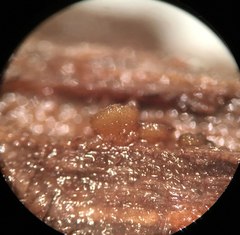 Ascobolus lignatilis