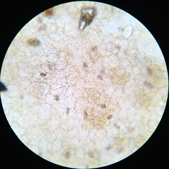 Ascobolus lignatilis