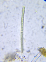 Rhizoclonium