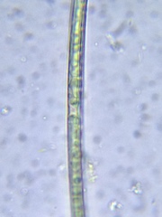 Rhizoclonium
