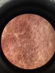 Fusarium oxysporum
