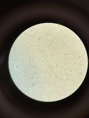 Fusarium oxysporum