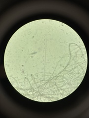 Fusarium oxysporum