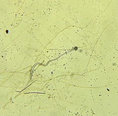 Aspergillus niger