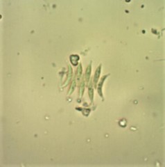Tetradesmus lagerheimii