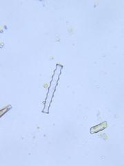 Pleurotaenium nodosum