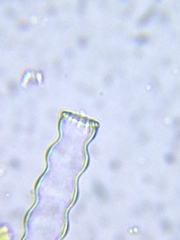 Pleurotaenium nodosum