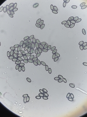 Scutellinia olivascens